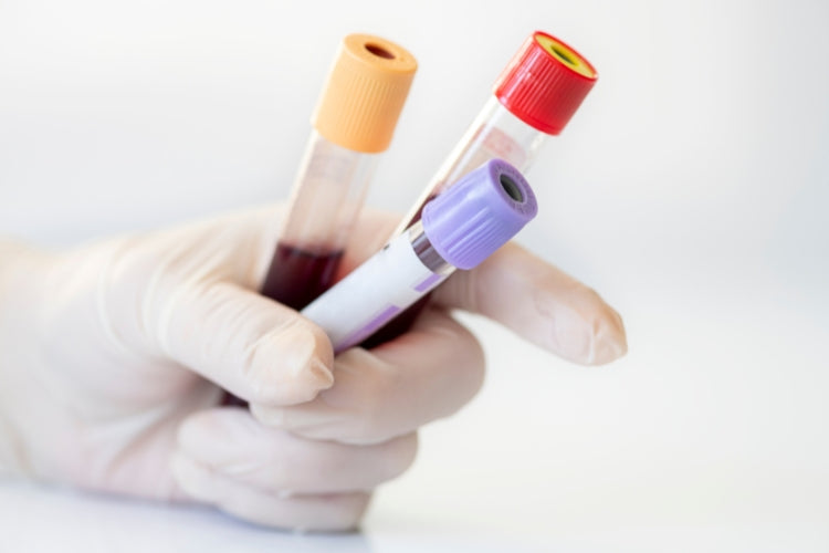 We provide the most comprehensive health tests on the market, designed for both men and women, at an affordable price.
