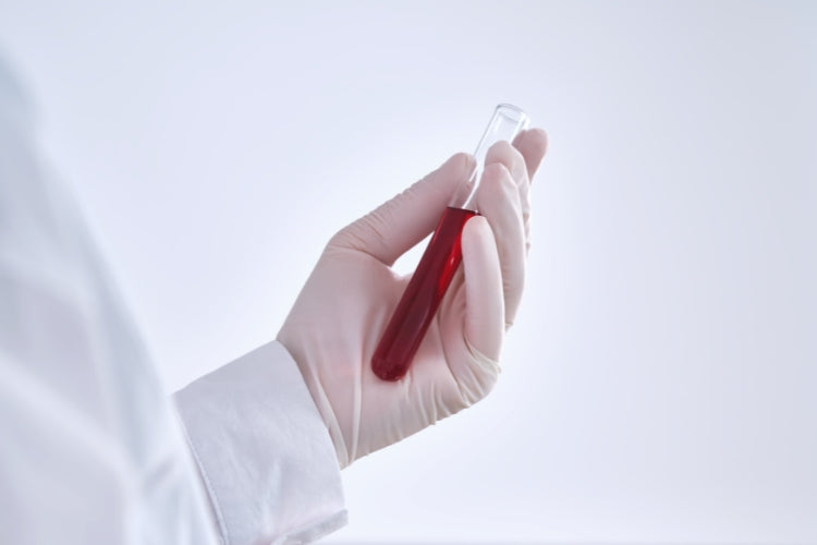 Our Essential Check Panels provide valuable insights into your health by focusing on key biomarkers.